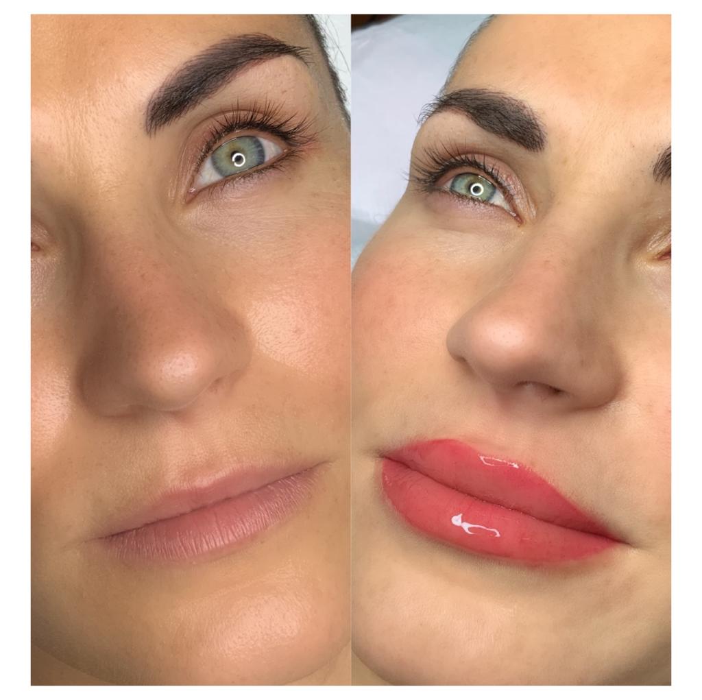 micropigmentación de labios Hollywood lips